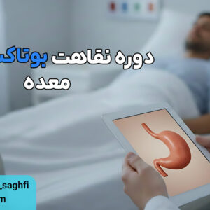 دوره نقاهت بوتاکس معده