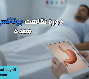 دوره نقاهت بوتاکس معده