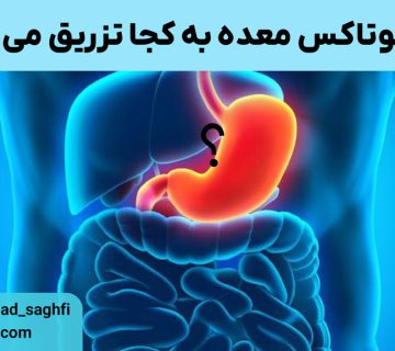 بوتاکس معده به کجا تزریق می‌شود؟