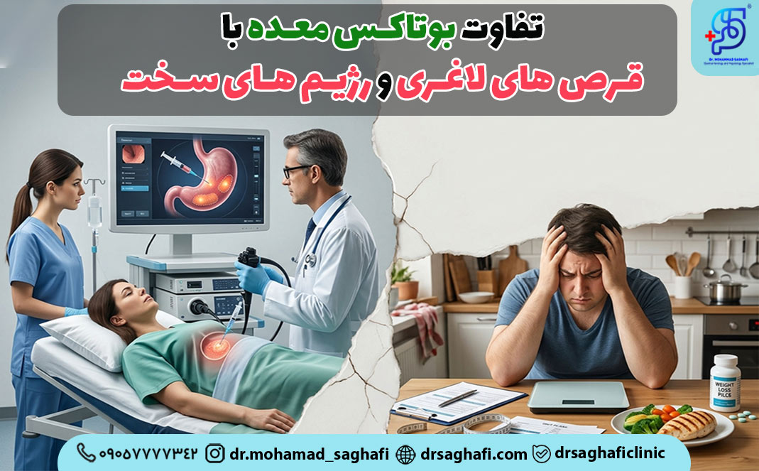 بوتاکس معده یا قرص های لاغری و رژیم های سخت