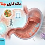 ماندگاری بوتاکس معده چقدر است؟