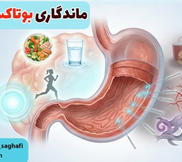 ماندگاری بوتاکس معده چقدر است؟