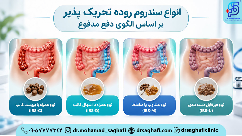 انواع سندروم روده تحریک پذیر بر اساس الگوی دفع مدفوع